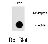 c Fos (FOS) pThr232 Rabbit Polyclonal Antibody - image 1