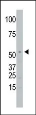 SPPL2A (N-term) Rabbit Polyclonal Antibody - image 1