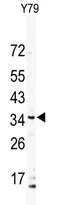VPS26C (N-term) Rabbit Polyclonal Antibody - image 1