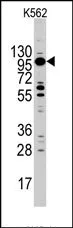 Myosin 1C (MYO1C) (C-term) Rabbit Polyclonal Antibody - image 1