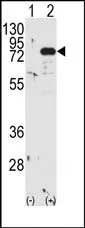 PKC beta 1 (PRKCB) (beta-1/2) (C-term) Rabbit Polyclonal Antibody - image 1