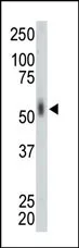 MNK2 (MKNK2) (N-term) Rabbit Polyclonal Antibody - image 1