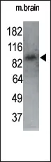 MARK1 (N-term) Rabbit Polyclonal Antibody - image 1