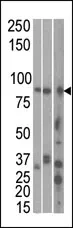 MARK1 (C-term) Rabbit Polyclonal Antibody - image 1