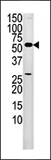 PANK2 (Center) Rabbit Polyclonal Antibody - image 1