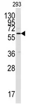 CAMK2A (C-term) Rabbit Polyclonal Antibody - image 1