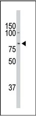 DCAMKL1 (DCLK1) (C-term) Rabbit Polyclonal Antibody - image 1