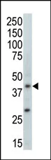 MAPK11 Rabbit Polyclonal Antibody - image 1