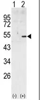 Cyclin A2 (CCNA2) (C-term) Rabbit Polyclonal Antibody - image 1