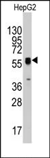 Thymidine Phosphorylase (TYMP) (Center) Rabbit Polyclonal Antibody - image 1