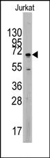 MAPK4 (C-term) Rabbit Polyclonal Antibody - image 1