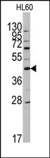 Apolipoprotein A V (APOA5) (N-term) Rabbit Polyclonal Antibody - image 1