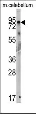 GIT1 Rabbit Polyclonal Antibody - image 1