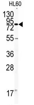 CD31 (PECAM1) (C-term) Rabbit Polyclonal Antibody - image 1
