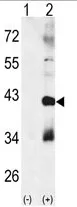 MAPK11 Rabbit Polyclonal Antibody - image 1