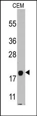 CXCL7 (PPBP) (C-term) Rabbit Polyclonal Antibody - image 1