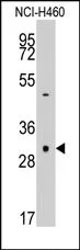 Caspase 3 (CASP3) Rabbit Polyclonal Antibody - image 1