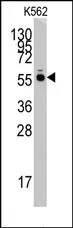 HARS (N-term) Rabbit Polyclonal Antibody - image 1