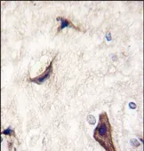 RASGRF1 Rabbit Polyclonal Antibody - image 1