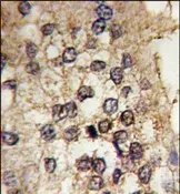 CLOCK (Center) Rabbit Polyclonal Antibody - image 1