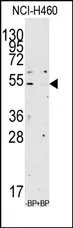 APOA4 (N-term) Rabbit Polyclonal Antibody - image 1