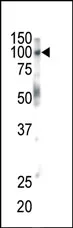 Eph receptor B1 (EPHB1) (C-term) Rabbit Polyclonal Antibody - image 1