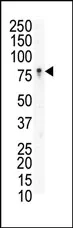 Eph receptor B3 (EPHB3) (N-term) Rabbit Polyclonal Antibody - image 1