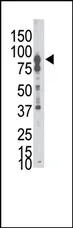Eph receptor B6 (EPHB6) (N-term) Rabbit Polyclonal Antibody - image 1