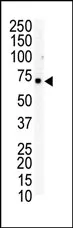 Eph receptor B6 (EPHB6) (C-term) Rabbit Polyclonal Antibody - image 1