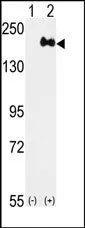 Her2 (ERBB2) Rabbit Polyclonal Antibody - image 1