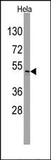 Integrin Linked Kinase (ILK) Rabbit Polyclonal Antibody - image 1