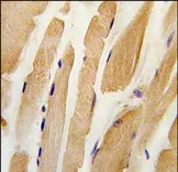 Integrin Linked Kinase (ILK) Rabbit Polyclonal Antibody - image 1