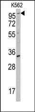 ROR2 Rabbit Polyclonal Antibody - image 1