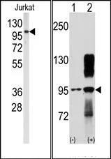 DDR2 Rabbit Polyclonal Antibody - image 1