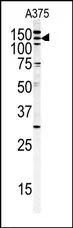 c Abl (ABL1) (C-term) Rabbit Polyclonal Antibody - image 1