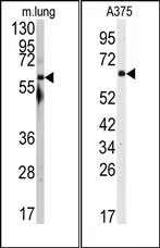 SRC (N-term) Rabbit Polyclonal Antibody - image 1