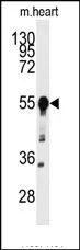 BACE1 (N-term) Rabbit Polyclonal Antibody - image 1