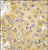 CCN2 (C-term) Rabbit Polyclonal Antibody - image 1