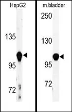 alpha Actinin 4 (ACTN4) (C-term) Rabbit Polyclonal Antibody - image 1