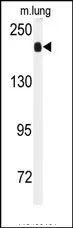 Angiotensin Converting Enzyme 1 (ACE) (C-term) Rabbit Polyclonal Antibody - image 1
