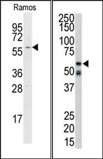RIP2 (RIPK2) (C-term) Rabbit Polyclonal Antibody - image 1