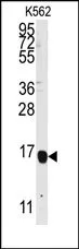 FLAP (ALOX5AP) Rabbit Polyclonal Antibody - image 1