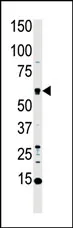 MST1 (STK4) (C-term) Rabbit Polyclonal Antibody - image 1