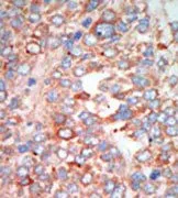 MST3 (STK24) (C-term) Rabbit Polyclonal Antibody - image 1