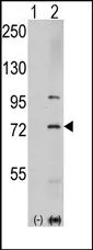 PAK1 Rabbit Polyclonal Antibody - image 1