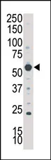 SGK3 (C8orf44-SGK3) (N-term) Rabbit Polyclonal Antibody - image 1