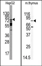 MARK2 (C-term) Rabbit Polyclonal Antibody - image 1