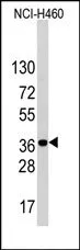 ARH (LDLRAP1) (C-term) Rabbit Polyclonal Antibody - image 1