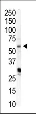 PIP5K1 alpha (PIP5K1A) (N-term) Rabbit Polyclonal Antibody - image 1