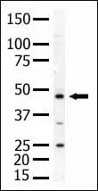 PIP5K2 alpha (PIP4K2A) (N-term) Rabbit Polyclonal Antibody - image 1